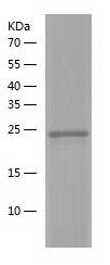    Rab24 / Recombinant Human Rab24