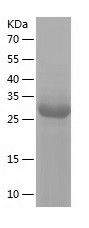    NEIL2 / Recombinant Human NEIL2