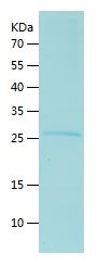    Arginine decarboxylase / Recombinant Human Arginine decarboxylase