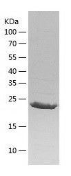    LRRC59 / Recombinant Human LRRC59