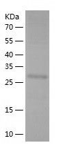    EXOSC8 / Recombinant Human EXOSC8