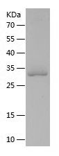    SKA1 / Recombinant Human SKA1