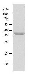    Mutarotase / Recombinant Human Mutarotase