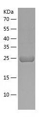    CTHRC1 / Recombinant Human CTHRC1