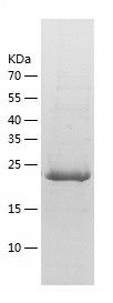    RAB39B / Recombinant Human RAB39B