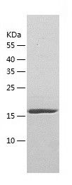    NUDT16 / Recombinant Human NUDT16