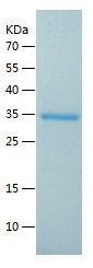    HLA B / Recombinant Human HLA B