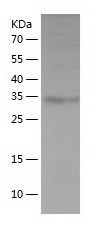    THAP11 / Recombinant Human THAP11