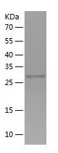    SGF29 / Recombinant Human SGF29