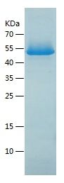    AMSH-LP / Recombinant Human AMSH-LP