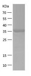    CCDC104 / Recombinant Human CCDC104