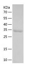    PDXP / Recombinant Human PDXP