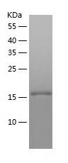    RBM18 / Recombinant Human RBM18