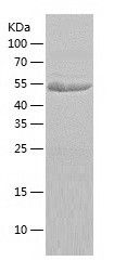    CDK5RAP3 / Recombinant Human CDK5RAP3