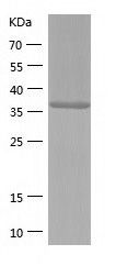    Calreticulin 3 / Recombinant Human Calreticulin 3