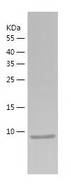    ZNF75A / Recombinant Human ZNF75A