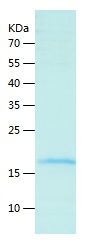    IL-17F / Recombinant Human IL-17F