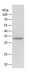    QKI / Recombinant Human QKI