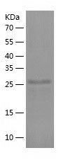    TRAX / Recombinant Human TRAX