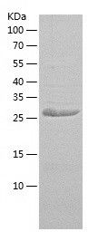    ZNF184 / Recombinant Human ZNF184