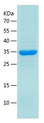    Monoacylglycerol Lipase / Recombinant Human Monoacylglycerol Lipase