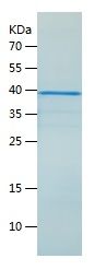    HNRPAB / Recombinant Human HNRPAB