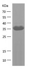    NAP1L4 / Recombinant Human NAP1L4