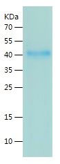    PRMT1 / Recombinant Human PRMT1