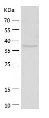    SH3GL3 / Recombinant Human SH3GL3