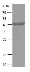 Recombinant Mouse ACY-1