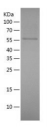    CRMP5 / Recombinant Human CRMP5