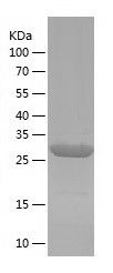    DHRS9 / Recombinant Human DHRS9