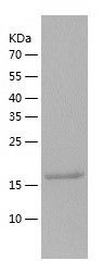    Sclerostin / Recombinant Human Sclerostin