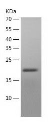    DBNDD2 / Recombinant Human DBNDD2