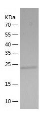    SIKE1 / Recombinant Human SIKE1