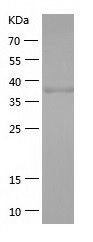    TXNDC4 / Recombinant Human TXNDC4