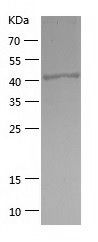    SYT11 / Recombinant Human SYT11