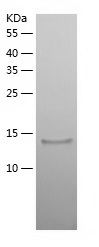    DUSP23 / Recombinant Human DUSP23