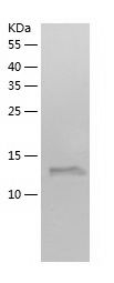    MRI / Recombinant Human MRI