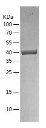    TGT / Recombinant Human TGT