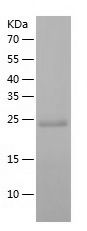    DGCR6L / Recombinant Human DGCR6L