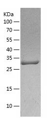    MRPL1 / Recombinant Human MRPL1