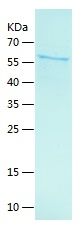    MDA5 / Recombinant Human MDA5