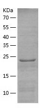    Rab34 / Recombinant Human Rab34