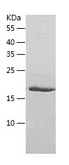    ULBP1 / Recombinant Human ULBP1