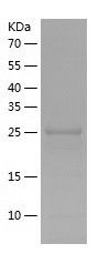 Recombinant Mouse PGAM1