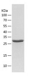    NDEL1 / Recombinant Human NDEL1