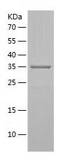    Serine racemase / Recombinant Human Serine racemase