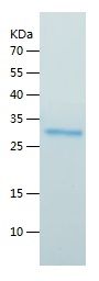    FGF 23 / Recombinant Human FGF 23