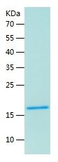    IL-22 / Recombinant Human IL-22